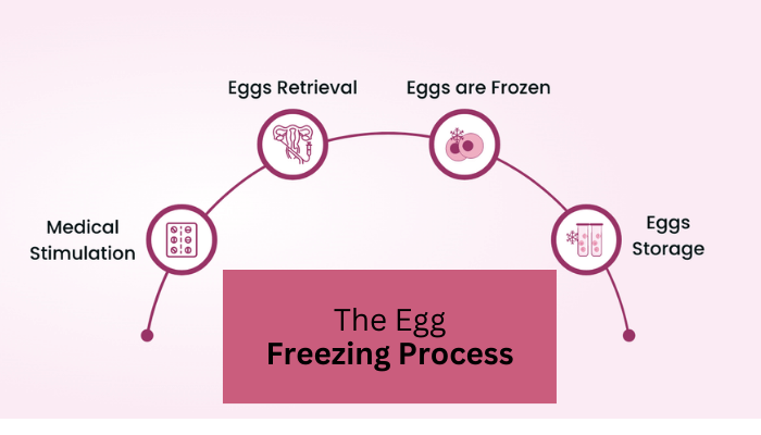 egg freezing treatment in Delhi